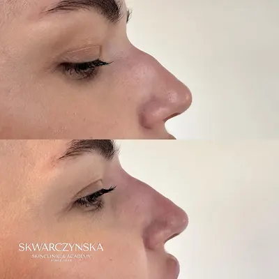 Skwarczyńska SkinClinic & Academy - Zabiegi, Szkolenia z Medycyny Estetycznej